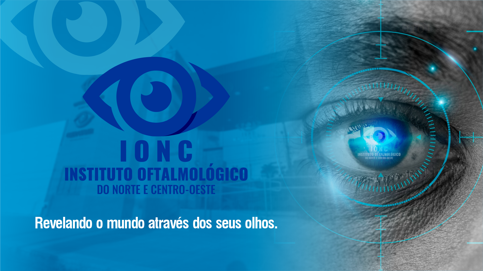 IONC